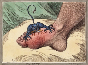 Healthy feet Podiatry - Gout