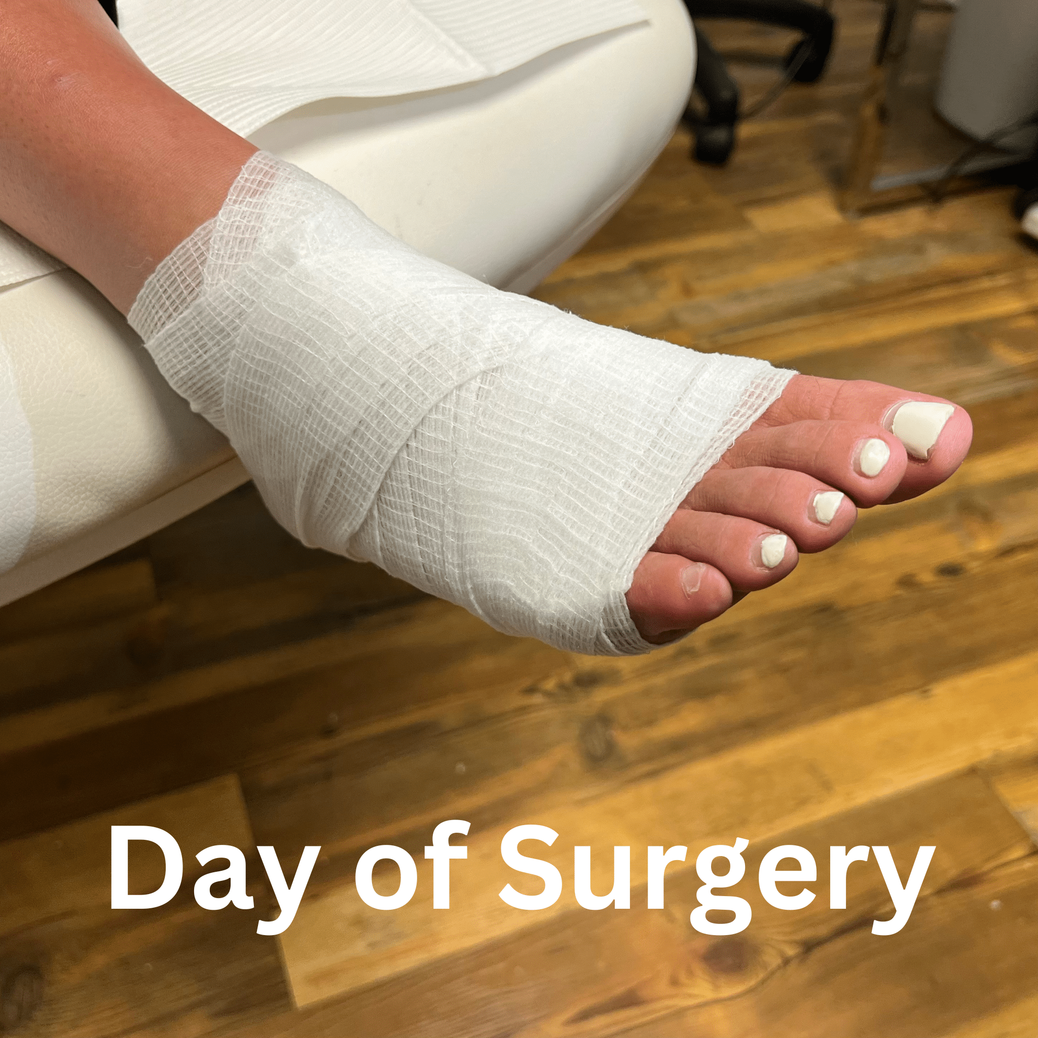 Day of Surgery (1)